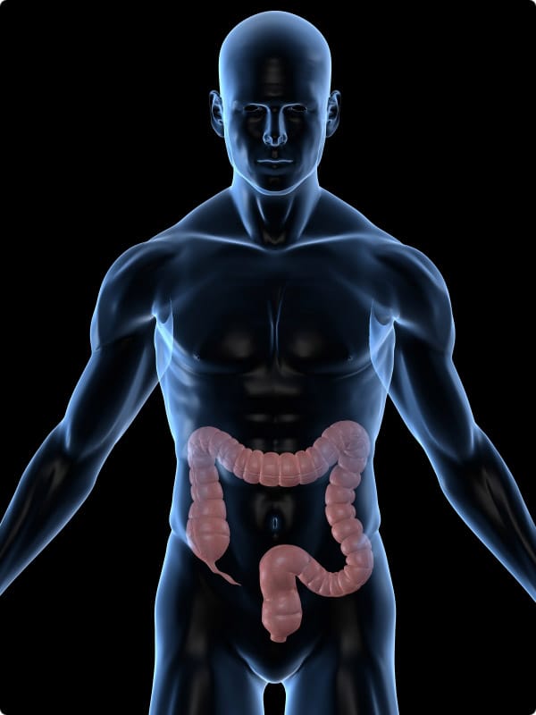 Rectal & Colon Cancer