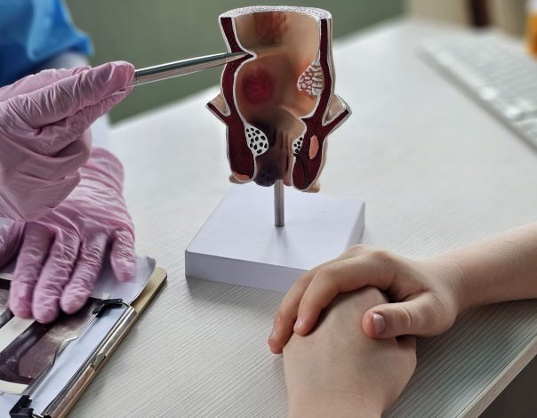 colonoscopy consultation